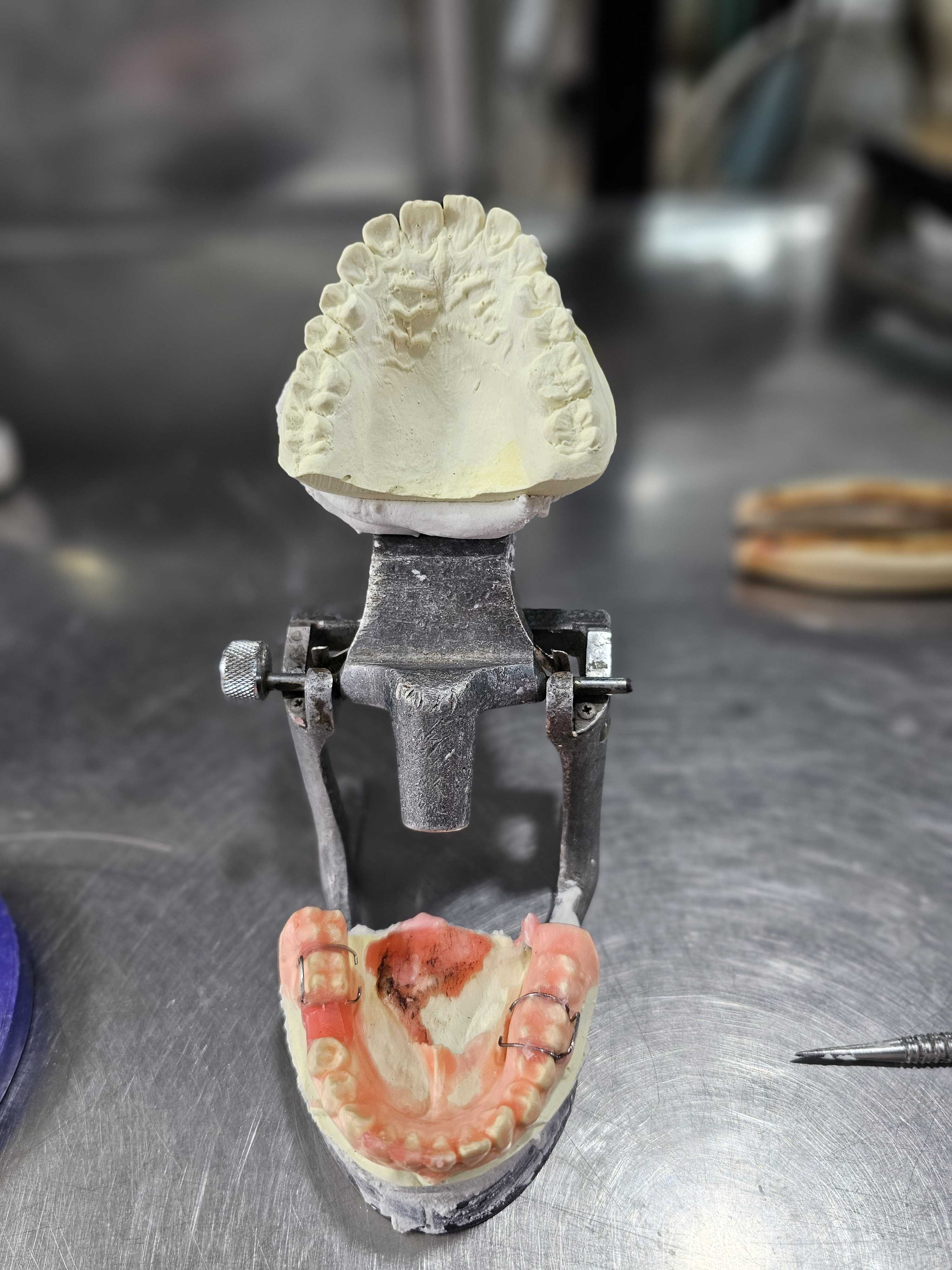 Dentures & Prosthetics